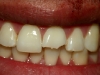 Lava Crowns 01 Before